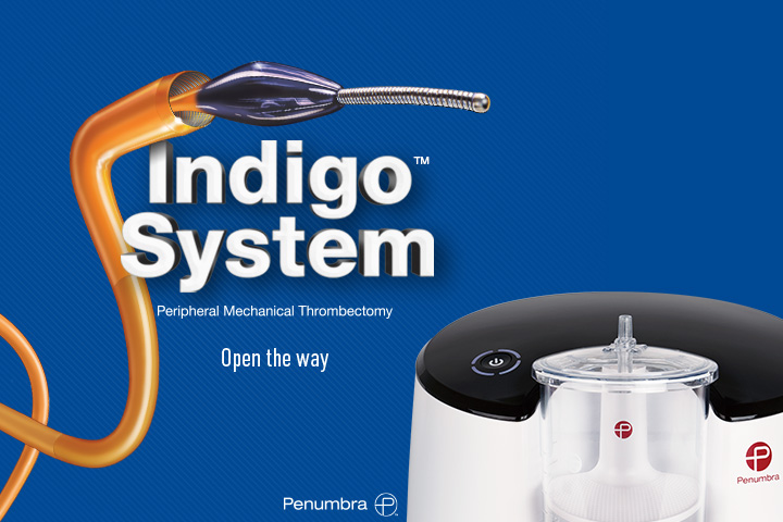 Indigo System